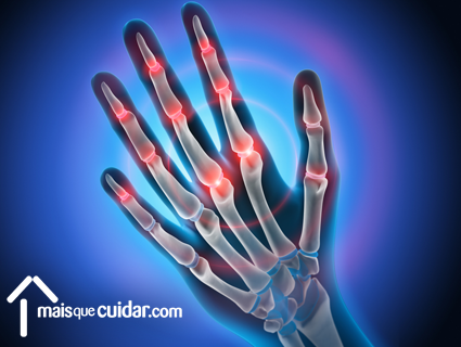 artrose nas mãos sintomas