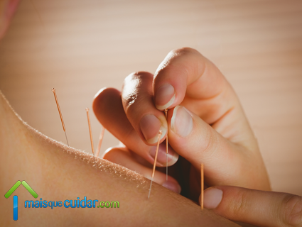 acupuntura para tendinite tratamentos