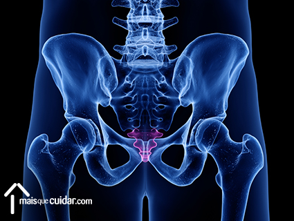 coccidínia inflamação no cóccix