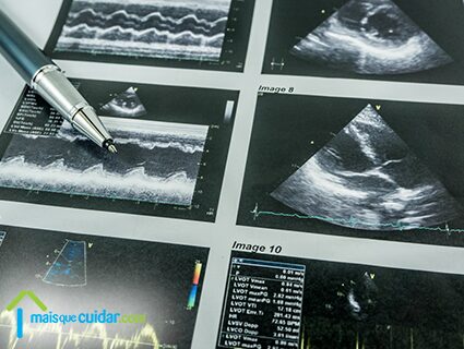 Insuficiência cardiaca diagnóstico