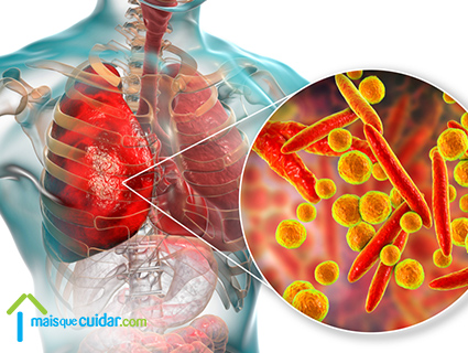 pneumonia o que e