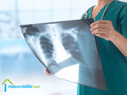 Enfisema pulmonar diagnóstico Enfisema pulmonar diagnóstico