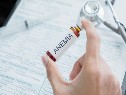 Anemia aplástica Anemia aplástica