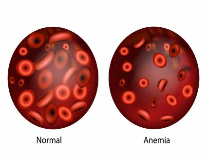 Anemia o que é