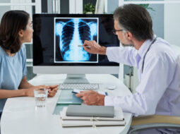 cancro pulmonar medicos