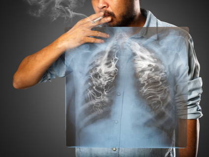 Causas do cancro do pulmão