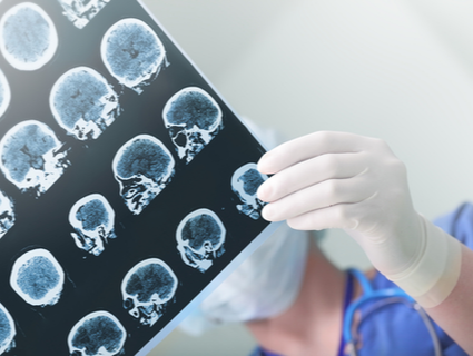 Diagnóstico do traumatismo craniano encefálico